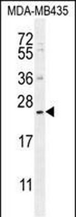 FAM109A Antibody in Western Blot (WB)