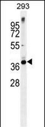 STX16 Polyclonal Antibody