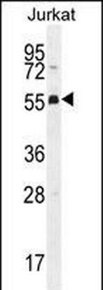 PODNL1 Antibody in Western Blot (WB)