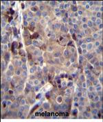 PRAMEF8 Polyclonal Antibody