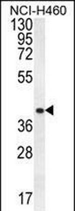 CCNYL3 Polyclonal Antibody