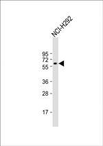 TBC1D3F Polyclonal Antibody