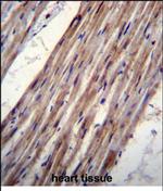 Kir6.1 (KCNJ8) Polyclonal Antibody