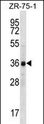 CCNYL2 Polyclonal Antibody