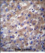 SLMO2 Polyclonal Antibody