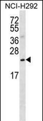 SLMO2 Antibody in Western Blot (WB)