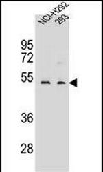 WDR86 Antibody in Western Blot (WB)