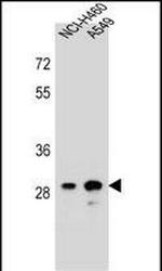 DHRS4L1 Polyclonal Antibody