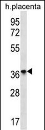 OR8D4 Polyclonal Antibody