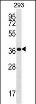 OR10H5 Polyclonal Antibody