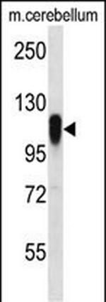 FBXO41 Polyclonal Antibody