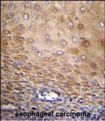 TMEM43 Polyclonal Antibody