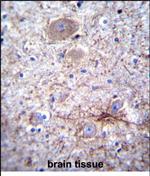 PCDHA7 Antibody in Immunohistochemistry (Paraffin) (IHC (P))