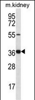 GRXCR1 Polyclonal Antibody