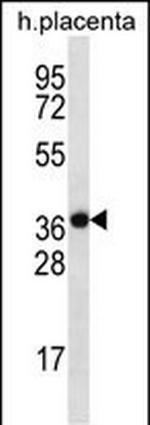 SLC38A8 Polyclonal Antibody