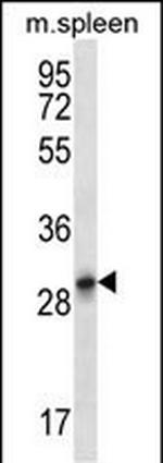 Krt222 Polyclonal Antibody