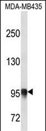 PLOD3 Polyclonal Antibody