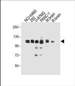 XYLT1 Polyclonal Antibody