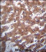 TRUB1 Polyclonal Antibody