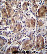 DULLARD Polyclonal Antibody
