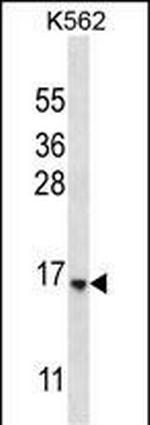 STARD5 Antibody in Western Blot (WB)