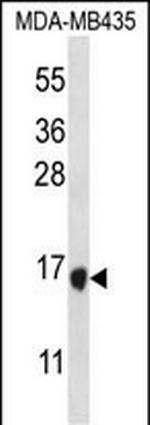 TAC4 Polyclonal Antibody