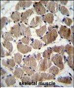 COCH Polyclonal Antibody