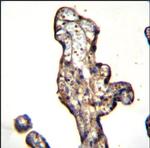 SLC15A3 Polyclonal Antibody