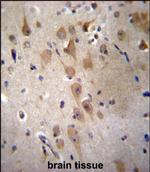 GRIP2 Polyclonal Antibody