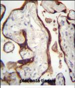 CSHL1 Polyclonal Antibody