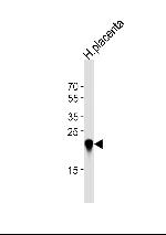 CSHL1 Antibody in Western Blot (WB)