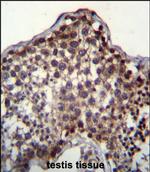 PQLC2 Polyclonal Antibody