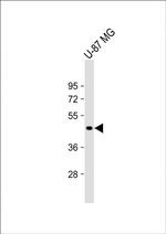 VAT1L Polyclonal Antibody