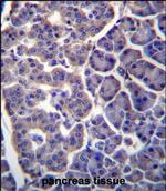 TM9SF2 Polyclonal Antibody