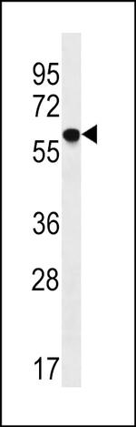 TM9SF2 Antibody in Western Blot (WB)