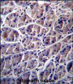 Calpain 8 Polyclonal Antibody