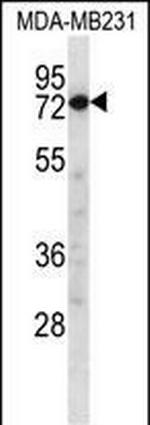 Calpain 8 Antibody in Western Blot (WB)