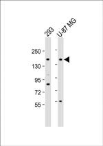 PCDH9 Antibody in Western Blot (WB)