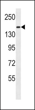 PCDH9 Antibody in Western Blot (WB)