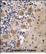 AFG3L2 Polyclonal Antibody