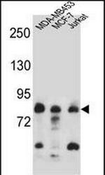 AFG3L2 Antibody in Western Blot (WB)