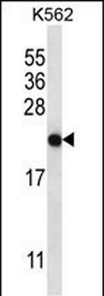 CHAC2 Antibody in Western Blot (WB)