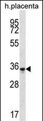 OR6K6 Polyclonal Antibody