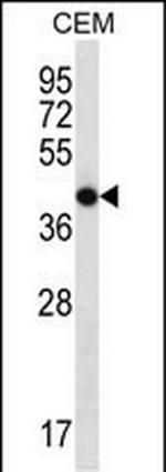 OR7G2 Polyclonal Antibody