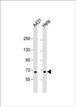 CCDC120 Polyclonal Antibody