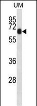 CCDC120 Antibody in Western Blot (WB)