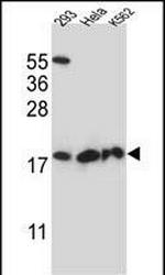 DHFRL1 Antibody in Western Blot (WB)