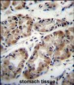 TAF8 Polyclonal Antibody