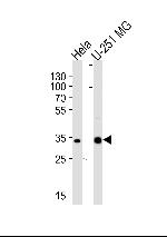 TAF8 Antibody in Western Blot (WB)
