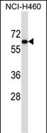 UGT2B11 Polyclonal Antibody